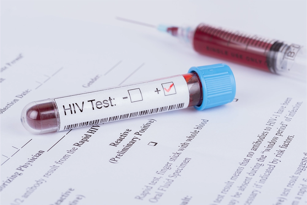 HIV treatment