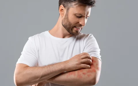 men skin sores